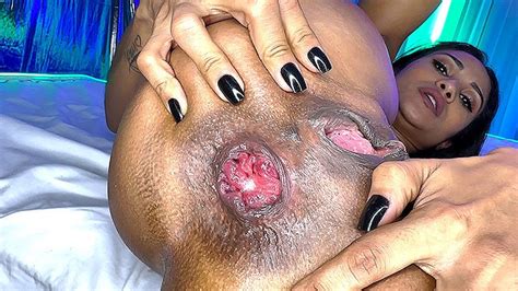 Flexi Skinny MILF Prolapse Her Asshole