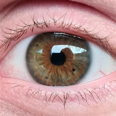 What are the black specks in my boyfriends eye? : r/medical