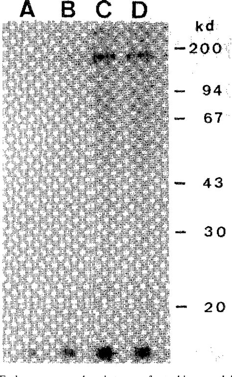 Figure 1 From Evidence That The Tyrosine Kinase Domain Of A Small