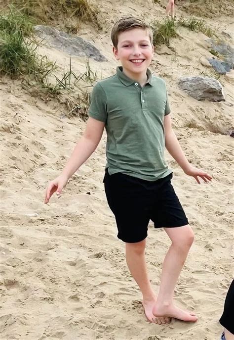 Boy Left Disfigured By Red Hot Sand From Disposable Barbecue Finds Courage To Walk On Beach