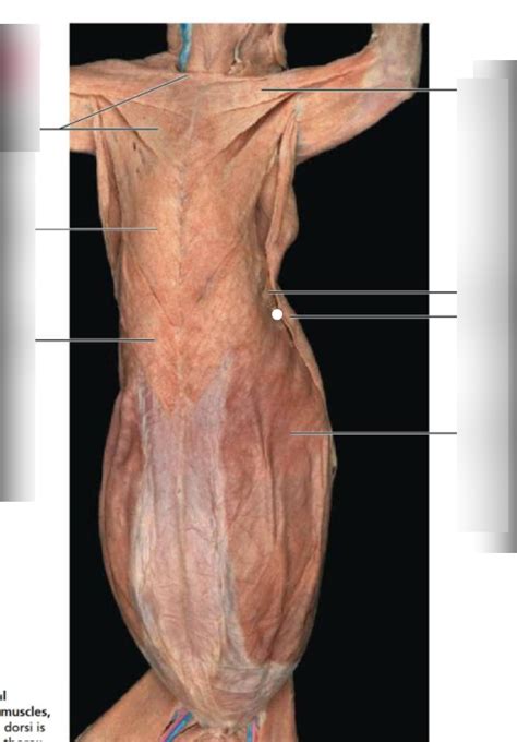 Abdomen Diagram Quizlet