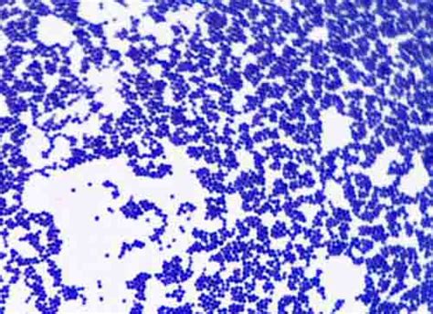 Enterobacter Aerogenes Gram Stain