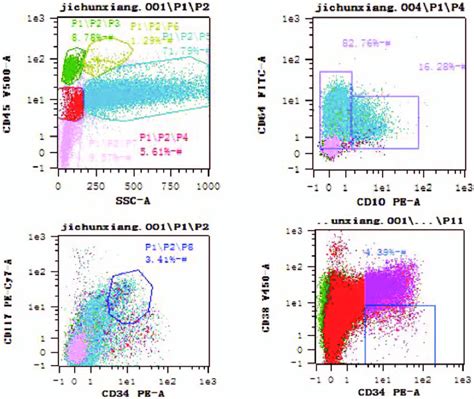 Flow Cytometric Immunophenotyping Graphs Of Bone Marrow Before