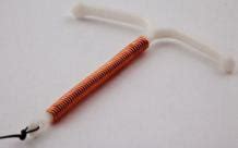 Как ставят спираль в матке