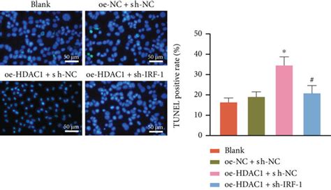 The Effect Of HDAC1 On IRF 1 Transcription And Hepatocyte Inflammatory