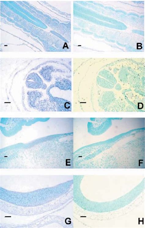 Pdf Investigation Of Mrna Expression For Secreted Frizzled Related