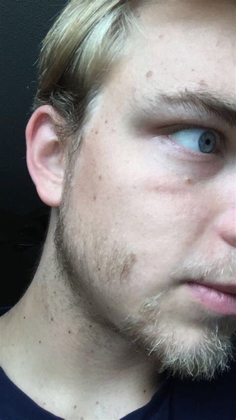 21 Year Old Patchy Blonde Beard Attempt 6th Week Update Beard Board