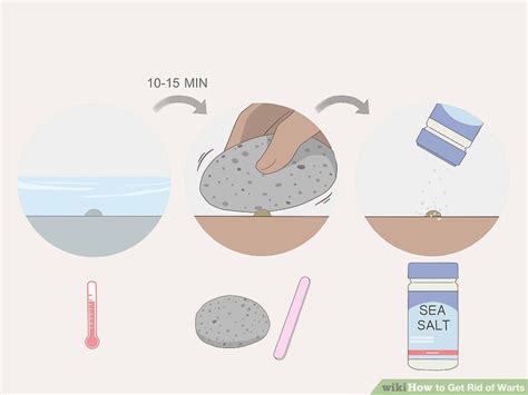 5 Ways to Get Rid of Warts - wikiHow