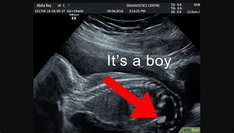 membaca hasil usg  mudah mamapapaid