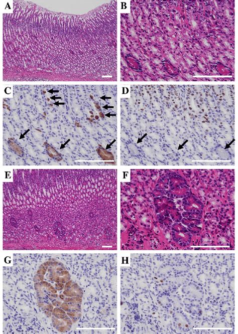 hematoxylin  eosin  staining  immunohistochemical staining