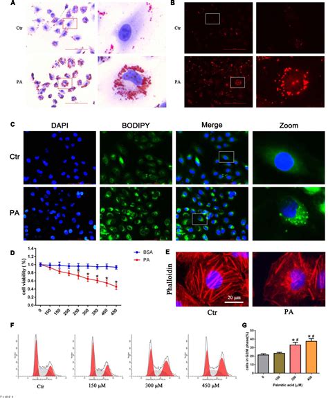 Figure 1 from Activation of the Nrf2/ARE signaling pathway protects ...