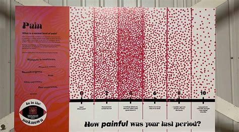 Endometriosis Into The Unknown At The Vagina Museum Review Bethnal