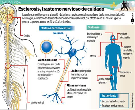 Infografia Esclerosis