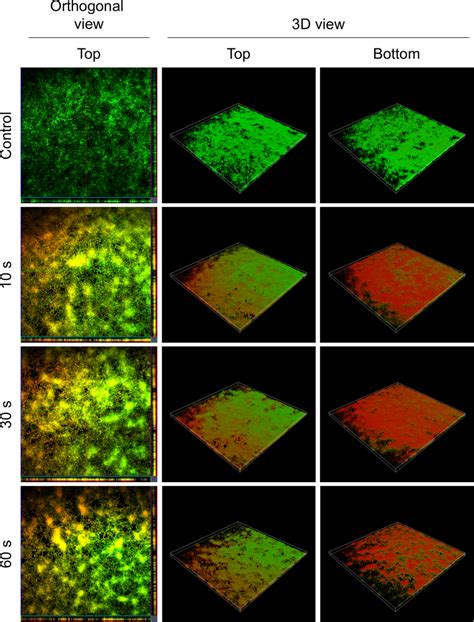 Confocal Laser Scanning Microscopy Clsm Images Of Live Deadstained