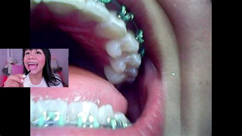 Lila Jordan Mini Cam Vore Fetish Endoscope Free Sex Video RedTube