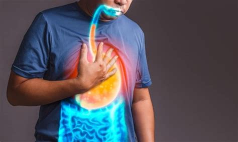 Acid Reflux Vs Heartburn Whats Are Their Differences