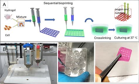 A D Bioprinted Tumor On A Chip Model Biomat The Biomaterials Network