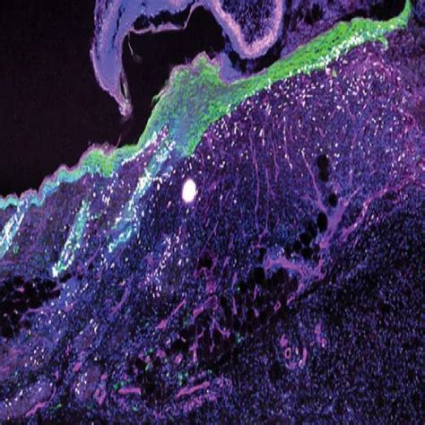 The Skin’s Secret Weapon: Researchers Uncover an Ancient Mechanism for ...