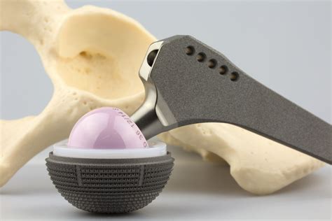 Производство эндопротезов