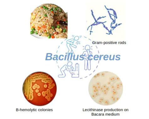 Bacillus cereus: Morphology, Disease, Biochemical Tests • Microbe Online