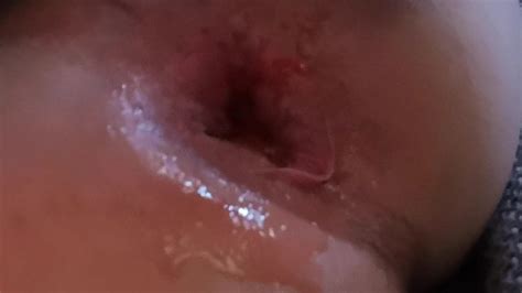 Gummihand Dildohand German Gay Amateur Amateur Porn XHamster