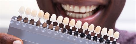 What The Color Of Your Teeth Says About You Delta Dental