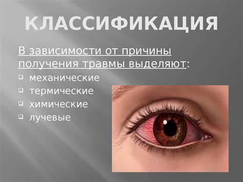 Травмы глаза - презентация онлайн
