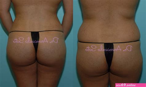 Big Ass Brazilian Butts Vol 11 Sexy Photos