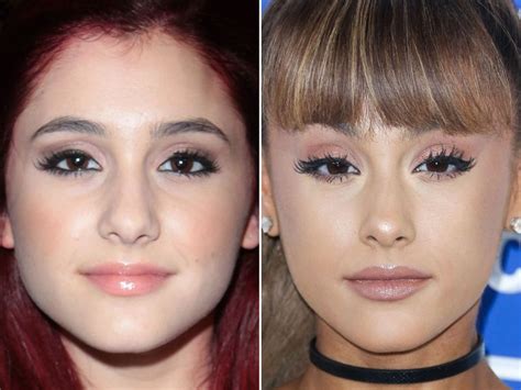 Ariana Grande Before And After In 2024 Ariana Grande Nose Ariana