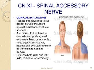 SPINAL ACCESSORY NERVE | Cranial nerves, Sternocleidomastoid muscle, Nerve