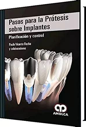 Libro Pasos Para La Prote Sis Sobre Implantes Cjs Meses Sin Intereses