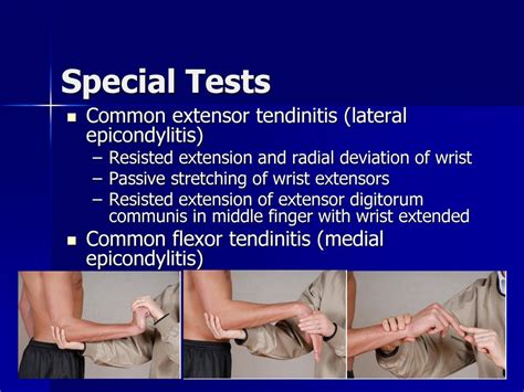 Medial Epicondylitis Orthofixar 2023