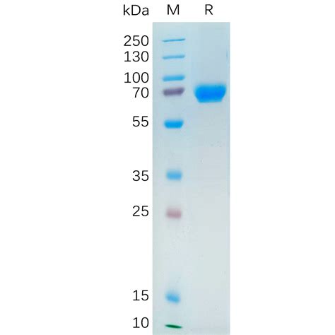 Human NRG1 Protein hFc Tag 专注肿瘤免疫