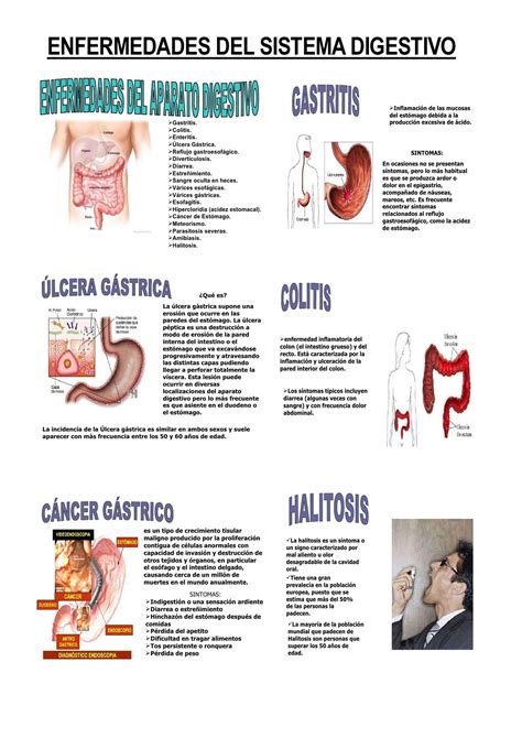 10 Enfermedades Del Sistema Digestivo Causas Y Tratamiento Nbkomputer