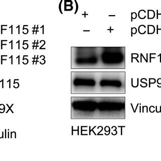 Ubiquitinspecific Protease 9X USP9X Regulates Ring Finger Protein