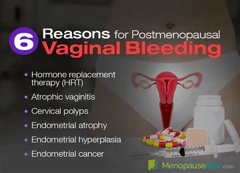 Vaginal Bleeding After Bowel Movement Reasons And Hot Sex Picture