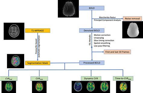 Acetazolamide Augmented BOLD MRI To Assess Whole Brain Cerebrovascular