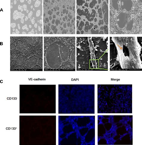 Cd133 Cancer Stem Like Cells Promoted Vm Formation In Acc A