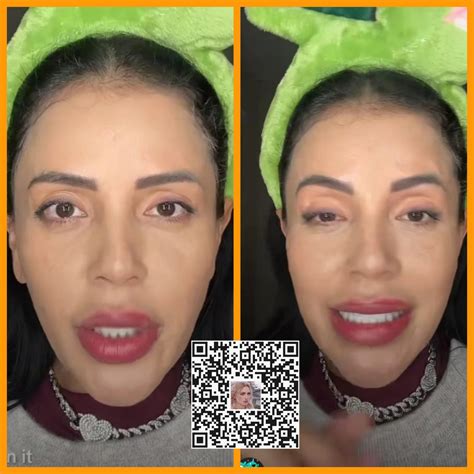 Jasmine Pineda's new chin implant is worrying her fans