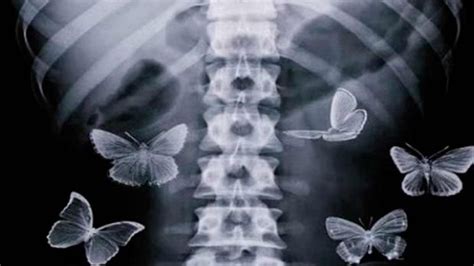 La explicación biológica de las mariposas en el estómago