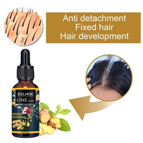 Buy 30ml Eelhoe Ginger Germinal Oil Hair Growth Nourishing Hair Care