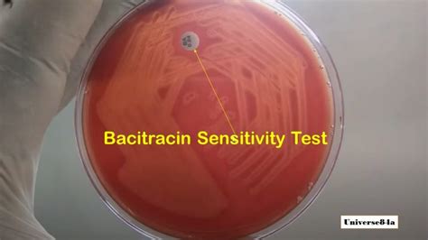 Bacitracin Sensitivity Test Introduction Principle Test Procedure