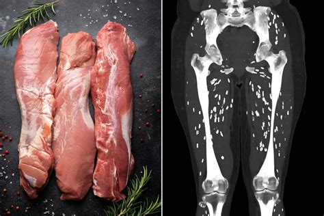 Doctor Shares Horrifying Scan Of Patients Legs Filled With Parasites