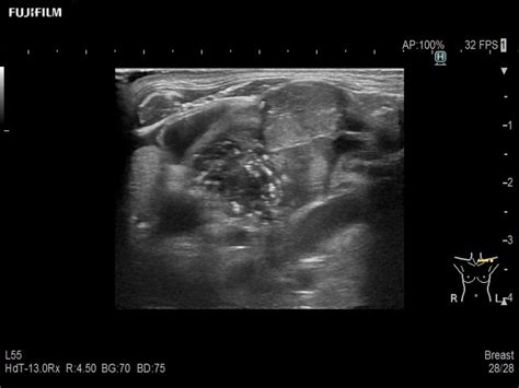 Radiology Ultrasound Arietta Fujifilm Healthcare