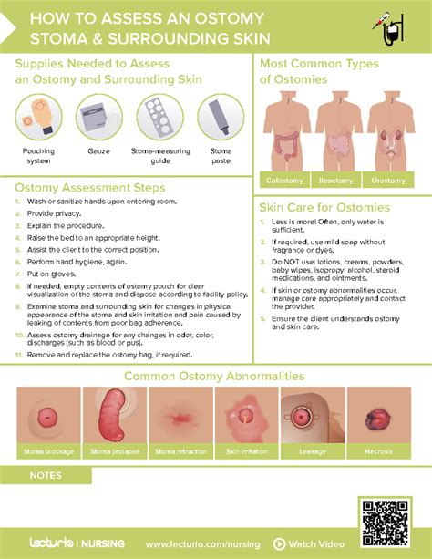 Nursing Cs How To Assess A Ostomy Stoma Surrounding Skin 01 Lecturio Nursing Watch Video Notes