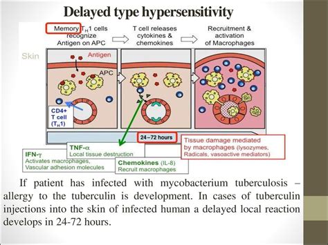 The General Diagnostics Of Tuberculosis Lecture 2 Online Presentation