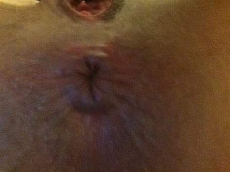 Hope Solo Naked Photos The Fappening