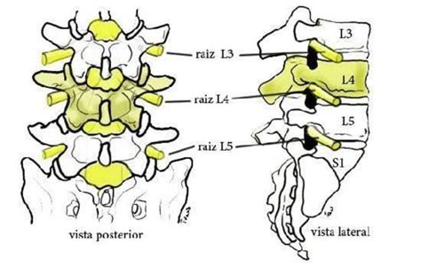 Esquema Mostrando A Posição Das Vértebras L3 L4 L5 E S1 Fonte Download Scientific Diagram