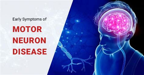 Symptoms Of Motor Neuron Dysfunction | Webmotor.org