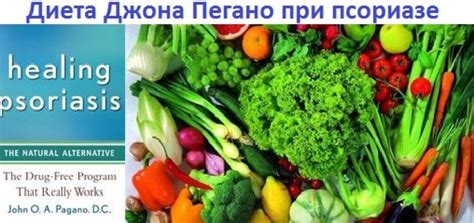Диета при псориазе – подробное меню и таблица продуктов